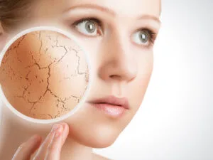 Ultimate Michigan Winter Skincare Guide Plastic Surgeon Approved Tips Ultimate Michigan Winter Skincare Guide Plastic Surgeon Approved Tips